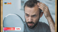 Почему выпадают волосы и на что обратить внимание, чтобы не упустить проблему — дерматолог-трихолог Кузьма Хобзей