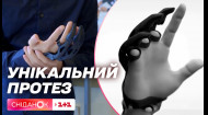 Протез пальців, надрукований на 3D-принтері: новини зі світу науки