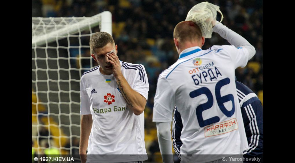 Стало відомо, скільки часу пропустять травмовані футболісти київського "Динамо"