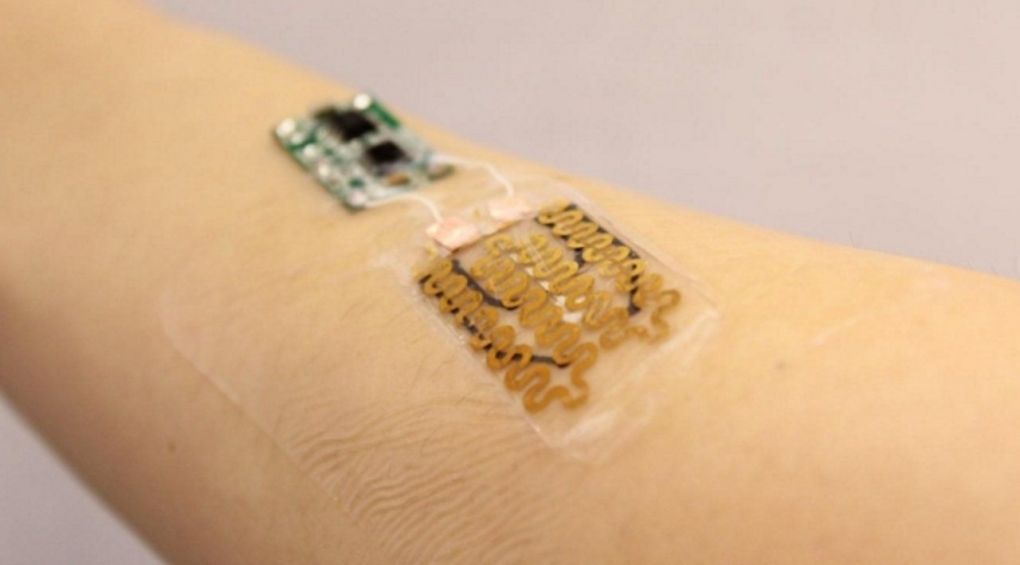 Учені винайшли електронний пластир, який загоює рани
