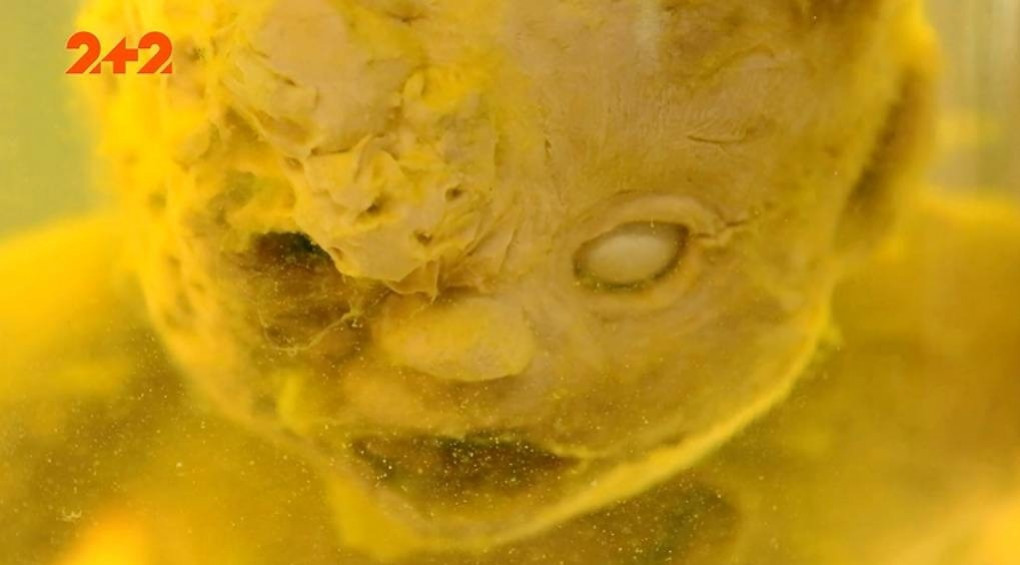 Неизвестный монстр: в частной коллекции украинца хранится эмбрион мутанта человека и осьминога