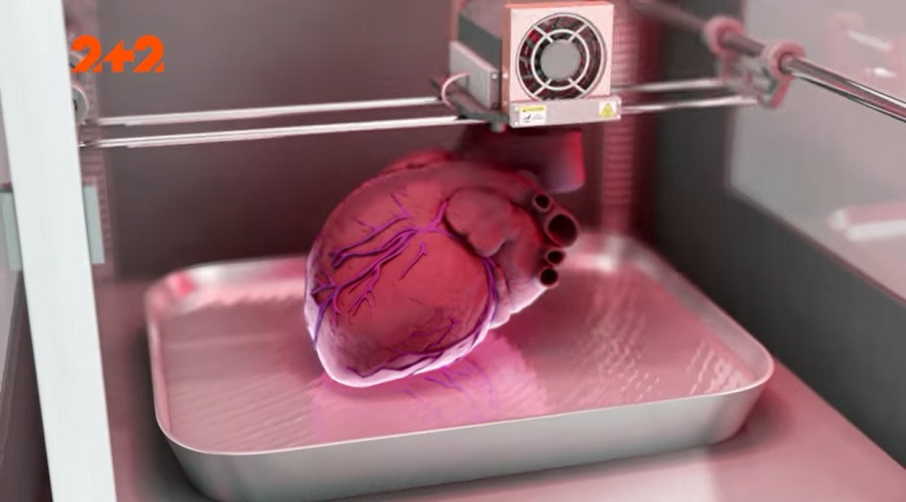 Напечатали сердце на 3D-принтере: врачи спасли жизнь девочки благодаря новым технологиям