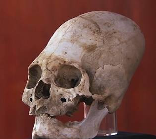 Мистификация вытянутых черепов античных людей: секретные и шокирующие мотивы древней элиты