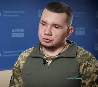 Вернуть зрение после удаления глаз: украинскому защитнику-саперу установят искусственное зрение