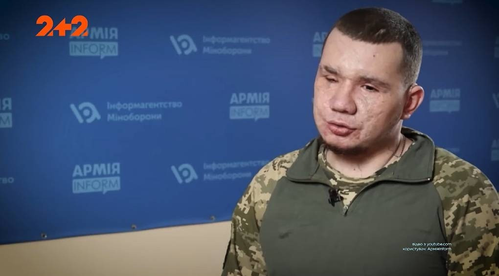 Вернуть зрение после удаления глаз: украинскому защитнику-саперу установят искусственное зрение