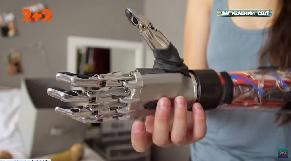 Бионические протезы: когда человек управляет искусственной рукой силой мысли