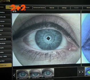 Глаза будущего: как работает новая технология цифрового зрения с использованием ИИ?